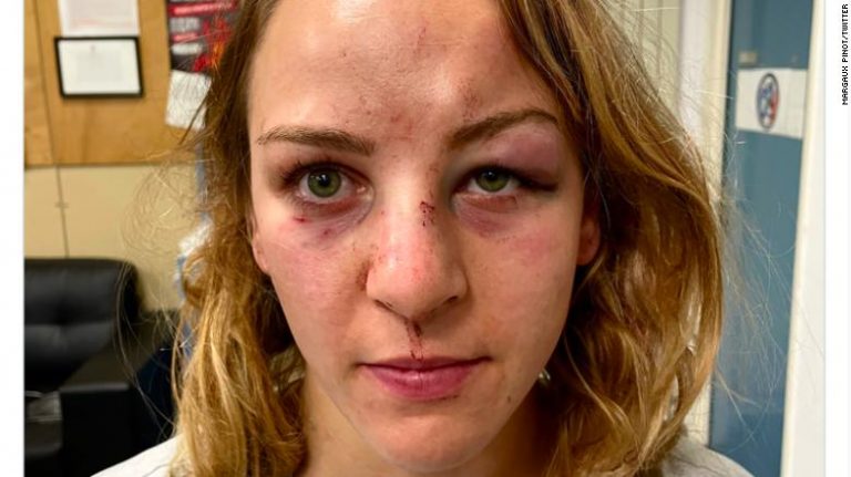 Margaux Pinot posted an image of her injuries on social media earlier this week